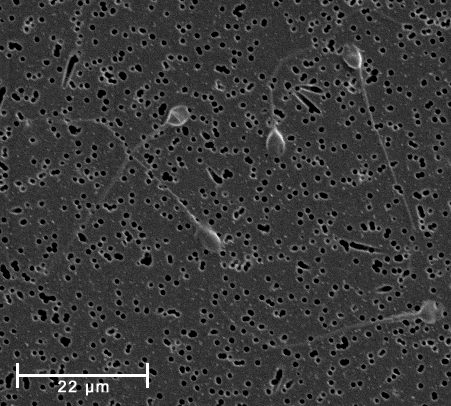 Micrografía electrónica de barrido (SEM) real de espermatozoides humanos maduros, magnificados 1000x.