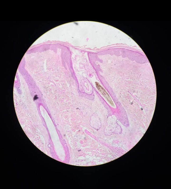 Corte histológico real de piel fina teñido con H&E mostrando la epidermis delgada sobre la dermis papilar y reticular.